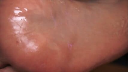 Iris V oily close up soles